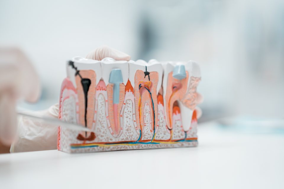 Zahnärztin erklärt Endodontie