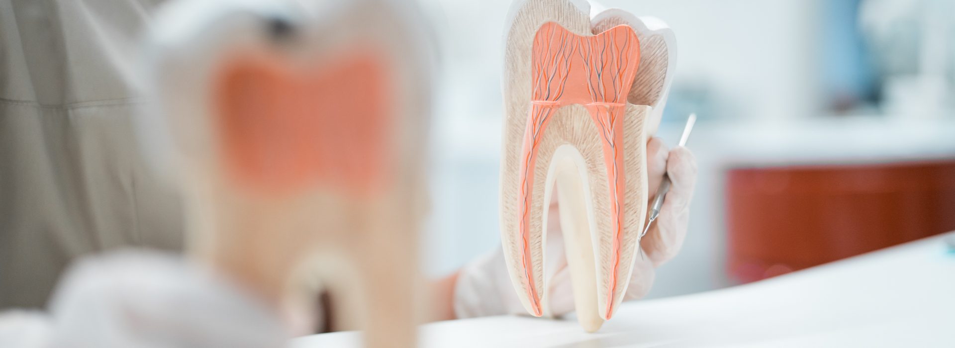 Erklärung der Wurzelbehandlung durch eine Mitarbeiterin anhand eines großen Modellzahns in der Zahnarztpraxis Mönchengladbach